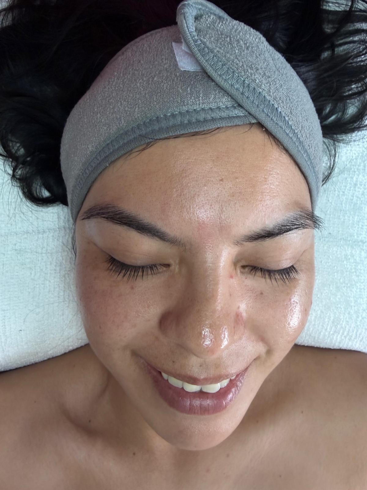 Professional facial treatment at Luméra Aesthetics