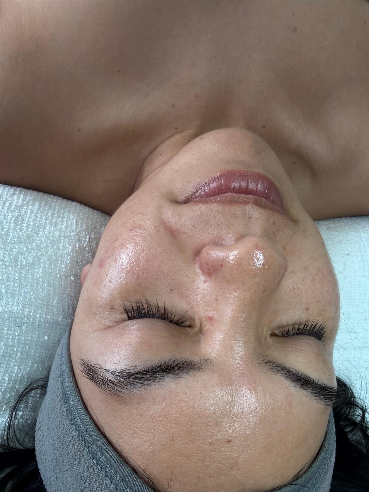 Professional facial treatment at Luméra Aesthetics