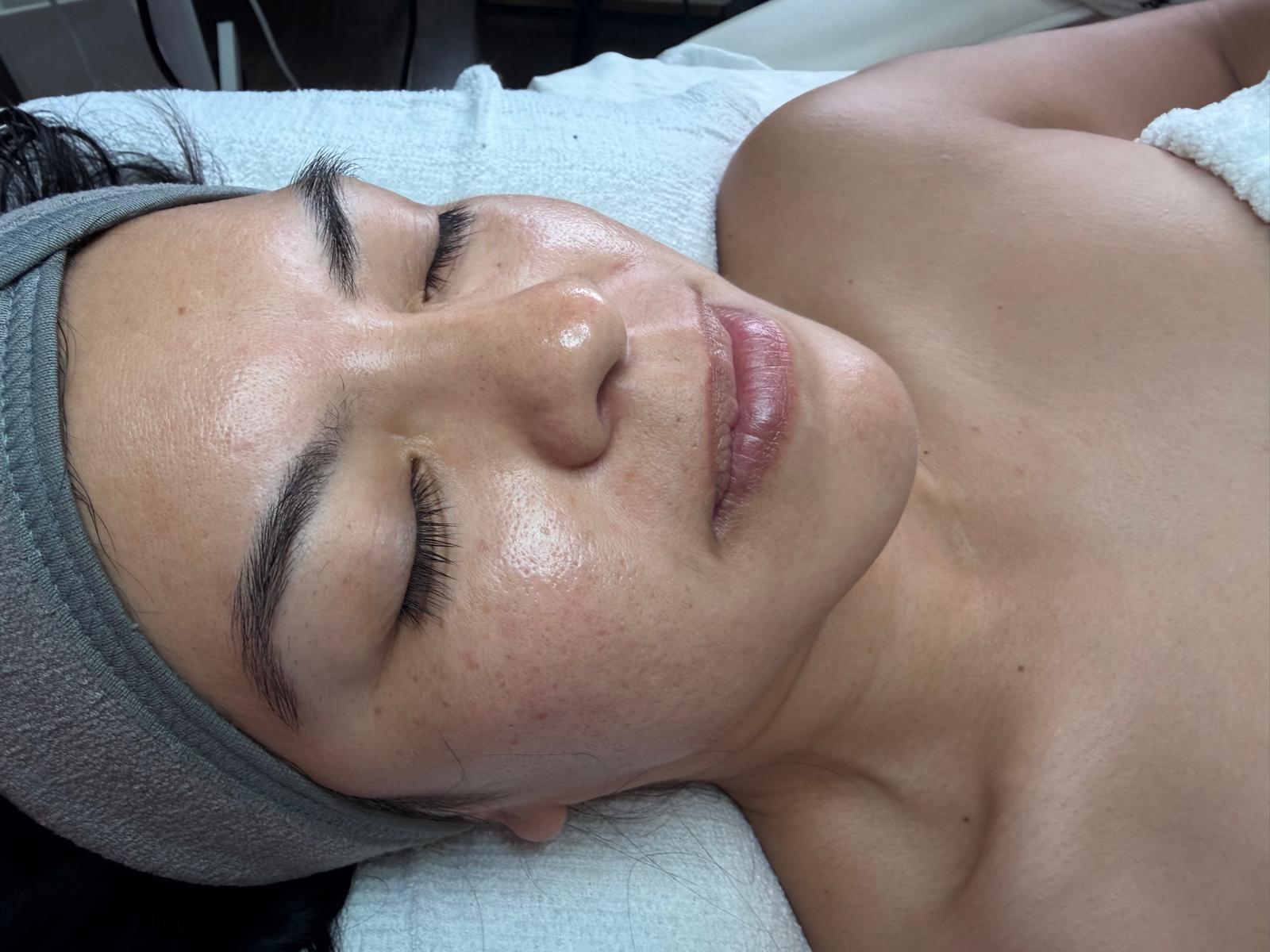 Professional facial treatment at Luméra Aesthetics
