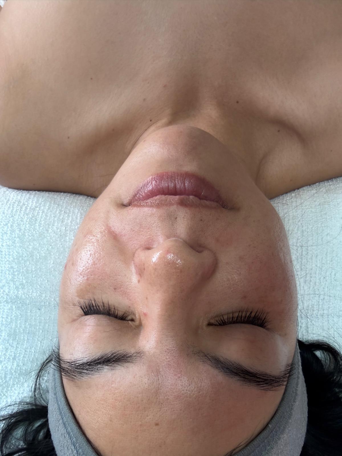 Professional facial treatment at Luméra Aesthetics