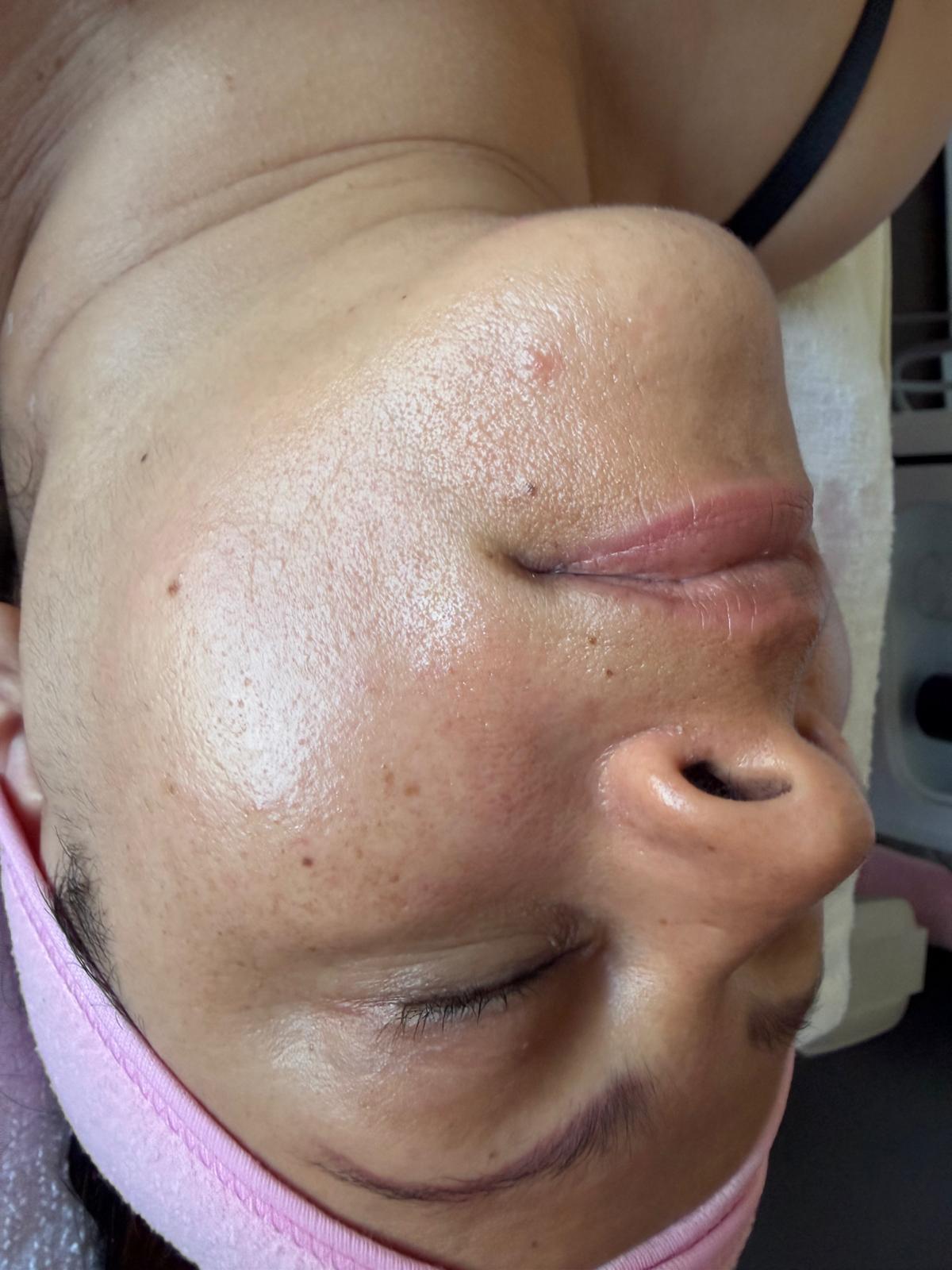 Professional facial treatment at Luméra Aesthetics